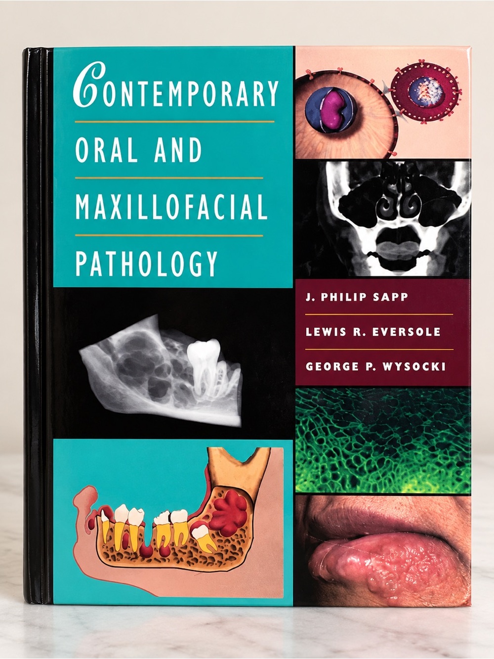 Contemporary Oral & Maxillofacial Pathology Sapp Eversole Wysocki Dental Text